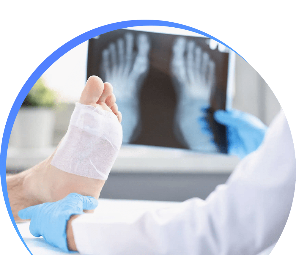 Doctor examining a bandaged foot with X-ray images in the background.